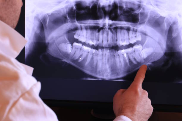 Best Pediatric Emergency Dentist in Carrollton, IL