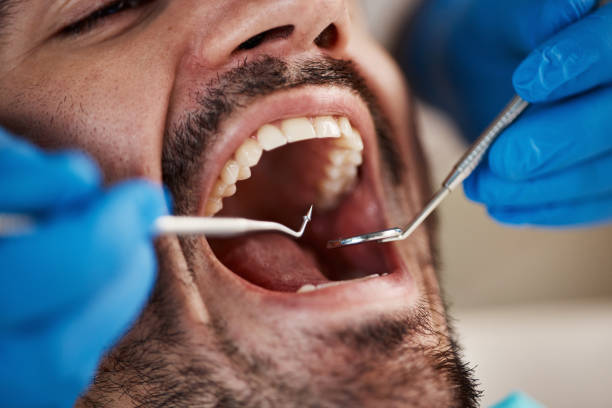 Best Emergency Tooth Extraction in Carrollton, IL