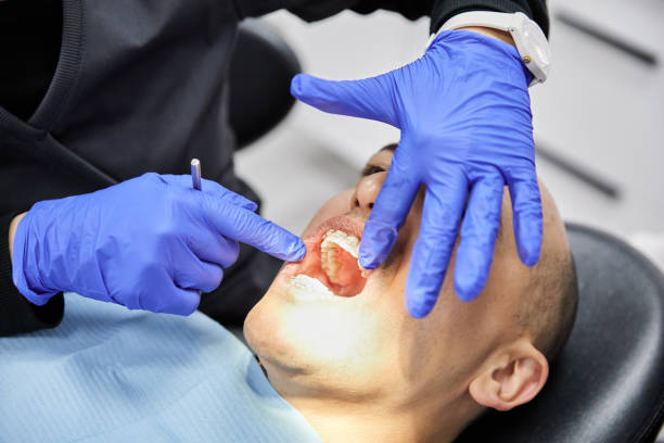 Best Emergency Dental Care for Broken or Chipped Teeth in Carrollton, IL
